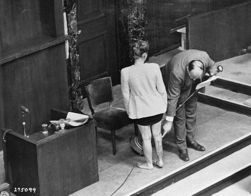 Dr. Alexander Leo zeigt auf die Narben an Jadwiga Dzidos Bein. Die Aufnahme entstand am 20. Dezember 1946 während des Nürnberger Ärzteprozesses. Jadwiga sagte als Zeugin aus.